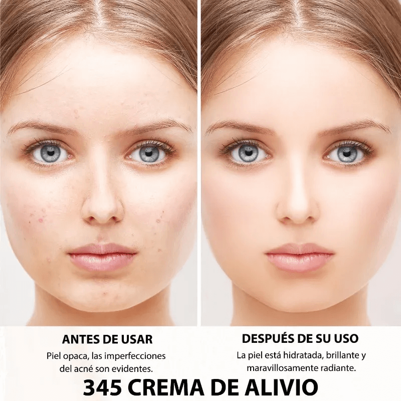 DR. ALTHEA CREAM 345 – REPARACIÓN AVANZADA QUE ALIVIA ROJECES Y MANCHAS POST-ACNÉ