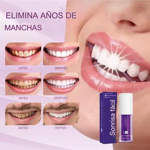 CREMA MORADA BLANQUEADORA V-34®️ | DESCUBRE TU VERDADERA SONRISA