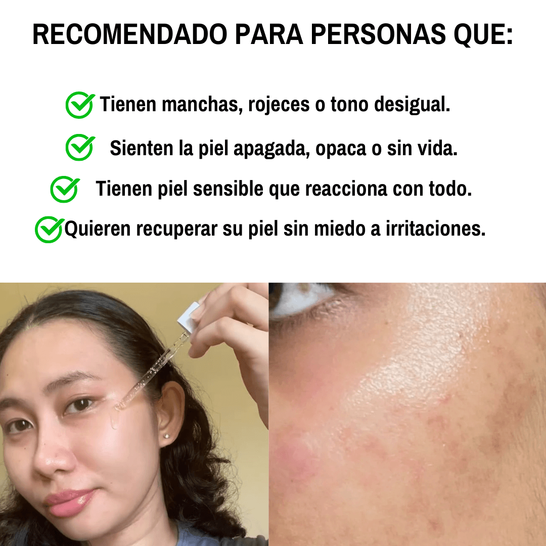 SKIN1004 CENTELLA COREANA 100 ML – EQUILIBRA, HIDRATA Y UNIFICA PARA UNA PIEL MÁS SUAVE Y RADIANTE