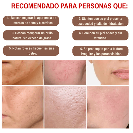 SEOUL 1988 SERUM 30 ML – CUIDADO INTENSIVO QUE AYUDA A SUAVIZAR, ILUMINAR Y REVITALIZAR LA PIEL