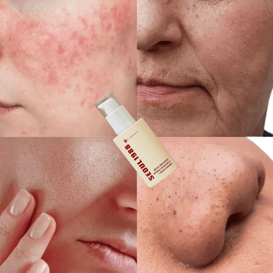SEOUL 1988 SERUM 30 ML – CUIDADO INTENSIVO QUE AYUDA A SUAVIZAR, ILUMINAR Y REVITALIZAR LA PIEL