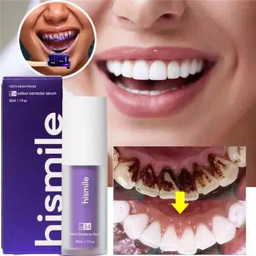 CREMA MORADA BLANQUEADORA V-34®️ | DESCUBRE TU VERDADERA SONRISA